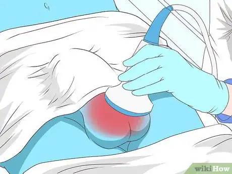 Imagen titulada Know if You Have Epididymitis Step 15