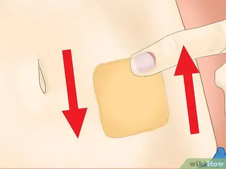Imagen titulada Use a Contraceptive Patch Step 7