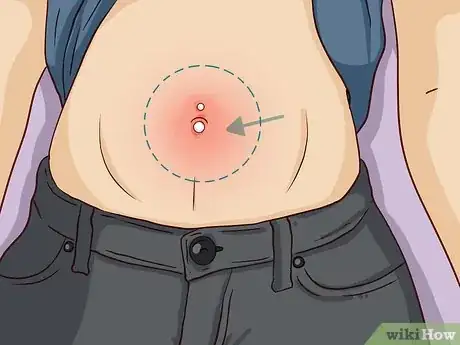 Imagen titulada Clean a Body Piercing Step 8