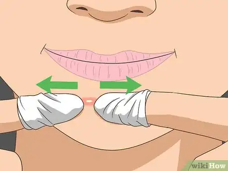 Imagen titulada Pop a Whitehead Step 10