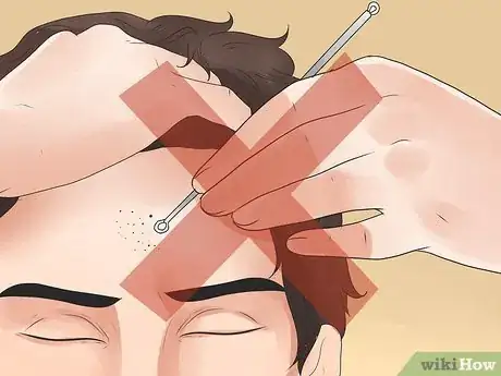 Imagen titulada Remove Blackheads Step 20