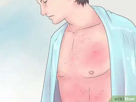 Imagen titulada Tell when You Are Contagious Step 3