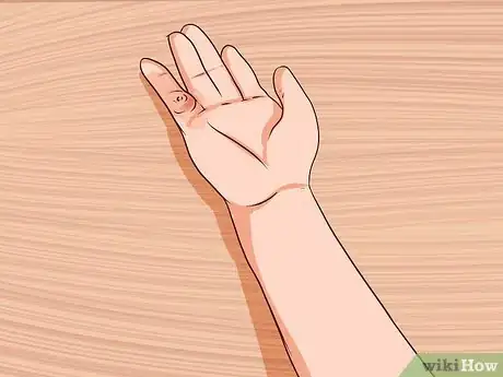 Imagen titulada Remove a Staple from Your Hand Step 9