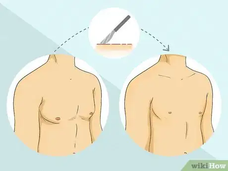 Imagen titulada Hide Gynecomastia at the Beach Step 8