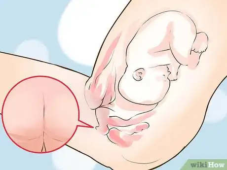 Imagen titulada Check a Cervix for Dilation Step 13