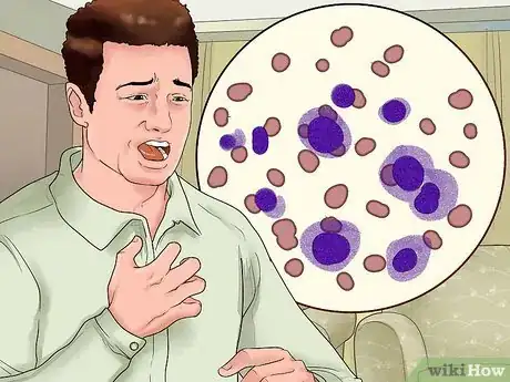 Imagen titulada Diagnose a Thymoma Step 8