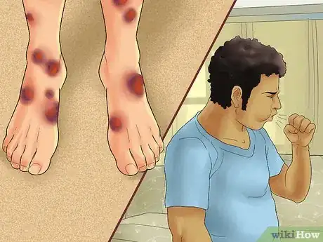 Imagen titulada Diagnose a Thymoma Step 9