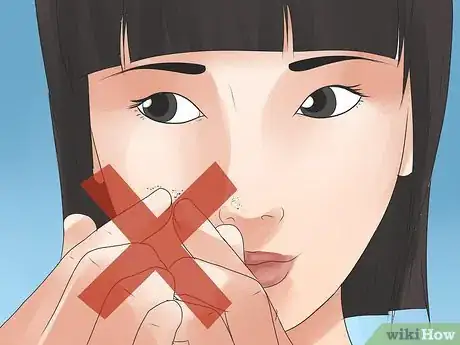 Imagen titulada Remove Blackheads Step 19