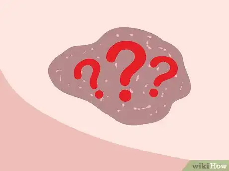 Imagen titulada Lighten Birthmarks Naturally Step 12