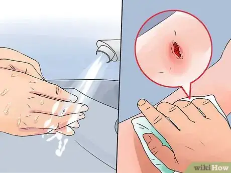 Imagen titulada Clean a Minor Wound Step 6