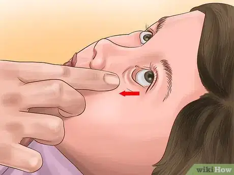 Imagen titulada Administer Eye Drops in Children Step 13
