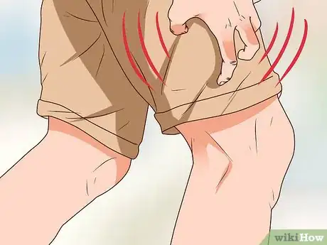 Imagen titulada Tell Signs of Sexual Infection from Penis Step 13