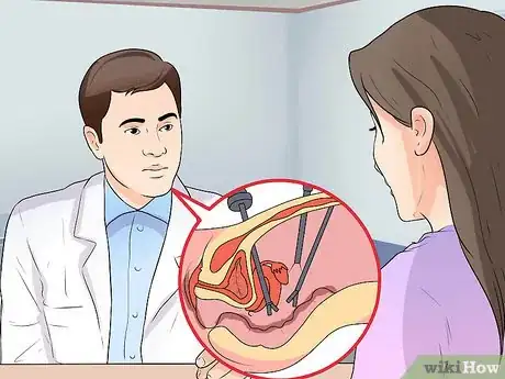 Imagen titulada Get Tied Tubes Untied Step 3