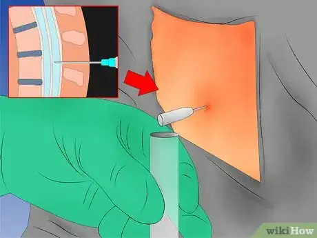 Imagen titulada Diagnose Multiple Sclerosis Step 6