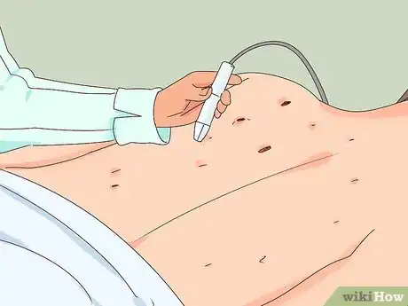 Imagen titulada Remove Blackheads on Your Back Step 5