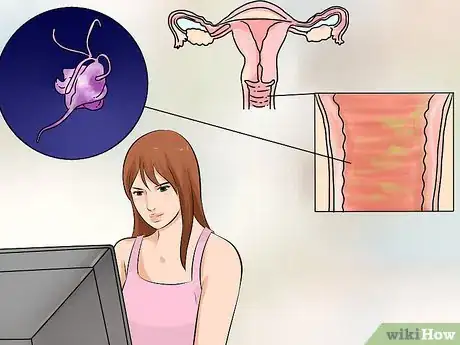 Imagen titulada Treat Vaginitis Step 10