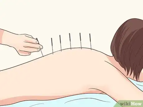Imagen titulada Deal with a Fear of Surgery Step 10