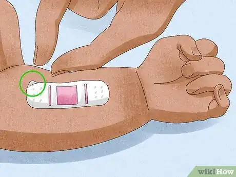 Imagen titulada Remove a Bandage from a Baby Step 5