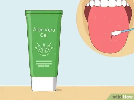 Imagen titulada Heal a Bitten Tongue Step 13