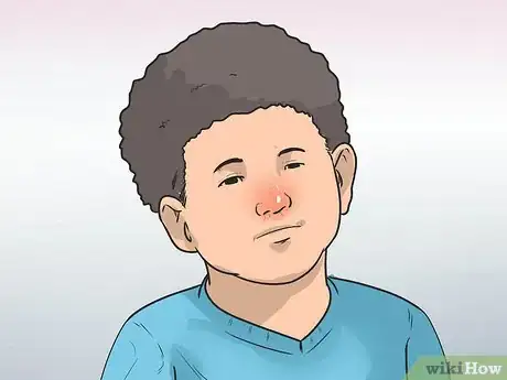 Imagen titulada Know if a Child Is Allergic to Cats Step 6