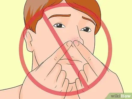 Imagen titulada Prevent Blackheads Step 9