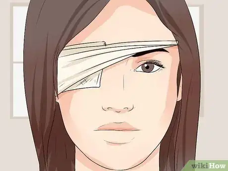 Imagen titulada Remove a Speck From Your Eye Step 7
