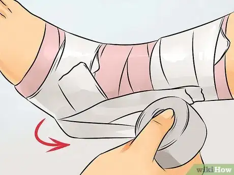 Imagen titulada Tape an Ankle Step 8
