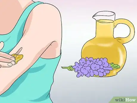Imagen titulada Remove Keloid Scars at Home Step 10