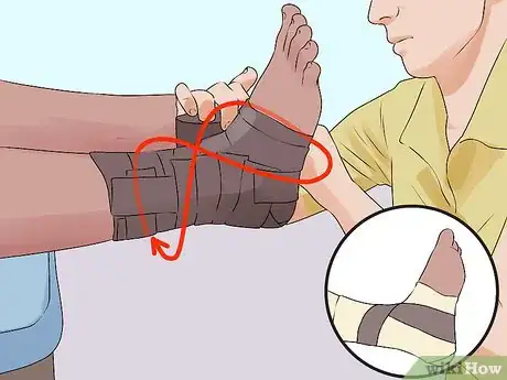 Imagen titulada Tape an Ankle Like an Athletic Trainer Step 10