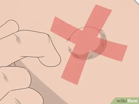 Imagen titulada Drain a Cyst Step 15