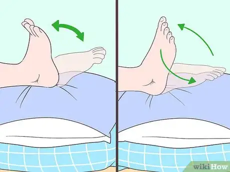 Imagen titulada Reduce Swelling After Surgery Step 7