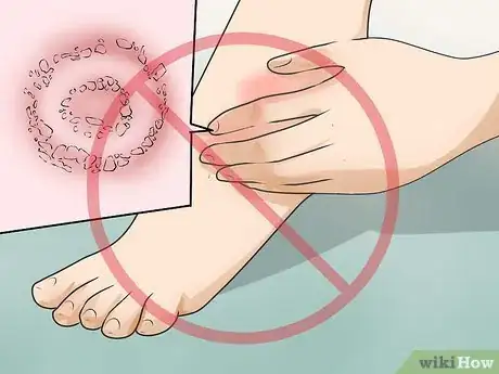 Imagen titulada Prevent the Spread of Fungal Infections Step 26