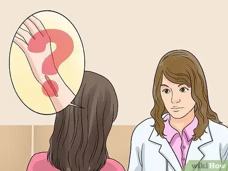 Imagen titulada Remove Keloid Scars at Home Step 16