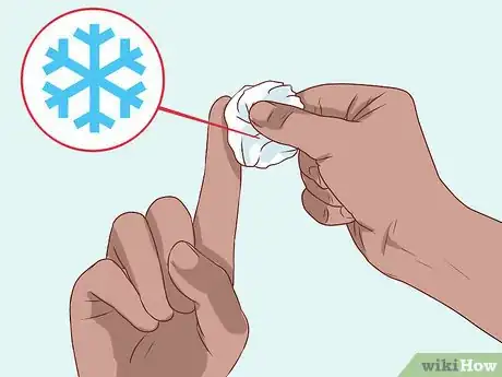 Imagen titulada Bandage Fingers or Toes Step 9