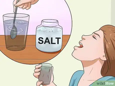 Imagen titulada Cure Post Nasal Drip Step 11