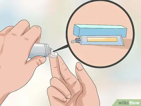 Imagen titulada Stop Bleeding Hemorrhoids Step 3