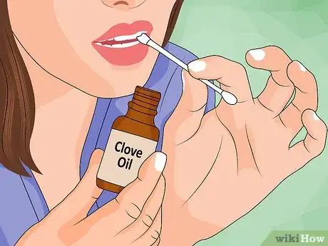 Imagen titulada Ease Wisdom Tooth Pain Step 6