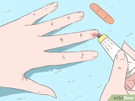 Imagen titulada Remove a Splinter Step 10