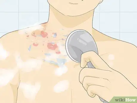 Imagen titulada Heal Raw Skin Step 1