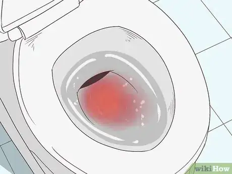 Imagen titulada Know if You Have Internal Bleeding Step 8
