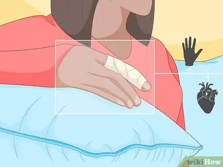 Imagen titulada Splint a Finger Step 6