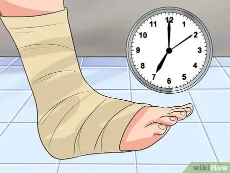 Imagen titulada Tape a Foot for Plantar Fasciitis Step 6