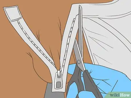 Imagen titulada Free a Penis from a Stuck Zipper Step 10