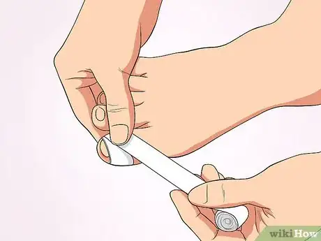 Imagen titulada Tell if an Ingrown Toenail Is Infected Step 6