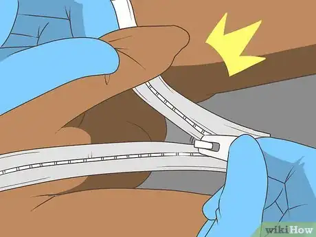 Imagen titulada Free a Penis from a Stuck Zipper Step 13