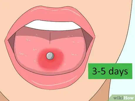 Imagen titulada Reduce Tongue Swelling Step 9