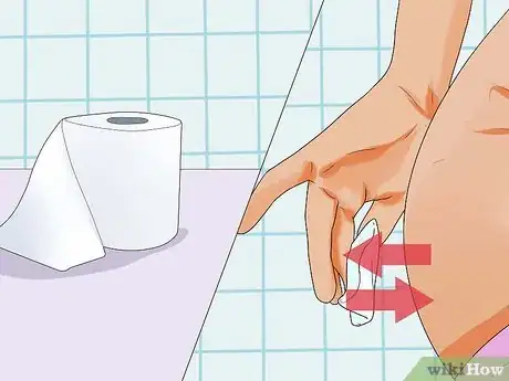 Imagen titulada Stop Bleeding Hemorrhoids Step 4