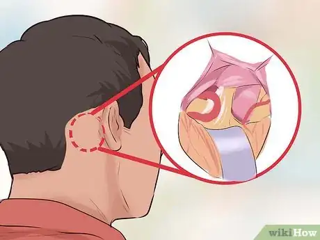 Imagen titulada Alleviate Pain Caused by Trigeminal Neuralgia Step 12