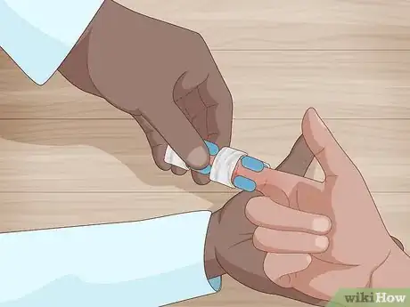 Imagen titulada Splint a Finger Step 9