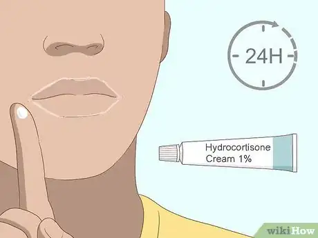 Imagen titulada Cure Angular Cheilitis Step 10